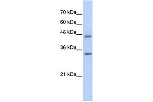 WB Suggested Anti-PRELP Antibody Titration: 0. (PRELP 抗体  (Middle Region))