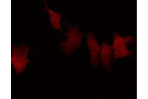 ABIN6269367 staining HeLa by IF/ICC. (NFKBIB 抗体  (N-Term))