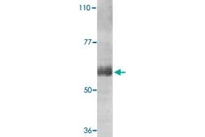 Western blot analysis of IL21R expression in human Raji cell lysate with IL21R polyclonal antibody  at 1 ug /mL . (IL21 Receptor 抗体  (AA 20-32))