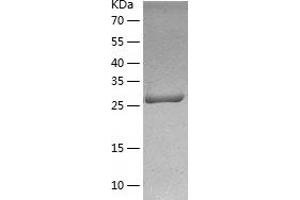 Western Blotting (WB) image for CD46 (CD46) (AA 35-313) protein (His tag) (ABIN7122209)