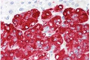 Image no. 2 for anti-Ring Finger Protein 139 (RNF139) (AA 72-121) antibody (ABIN6749727) (RNF139 抗体  (AA 72-121))