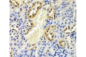 Immunohistochemistry of paraffin-embedded Mouse kidney using CDKN1B Polyclonal Antibody at dilution of 1:200 (40x lens). (CDKN1B 抗体)