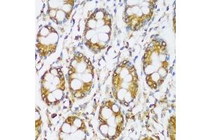 Immunohistochemistry of paraffin-embedded human colon using ERLIN1 antibody (ABIN7267005) at dilution of 1:100 (40x lens). (ERLIN1 抗体  (AA 259-348))
