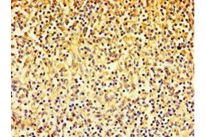 Immunohistochemistry of paraffin-embedded human spleen tissue using ABIN7143385 at dilution of 1:100 (F4/80 抗体  (AA 21-290))