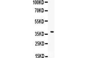 Western Blotting (WB) image for anti-CD86 (CD86) (AA 24-329) antibody (ABIN3042788)