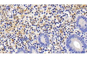 Detection of FAS in Human Appendix Tissue using Polyclonal Antibody to Factor Related Apoptosis (FAS) (FAS 抗体)