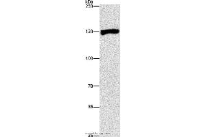 Western blot analysis of Raji cell, using UPF1 Polyclonal Antibody at dilution of 1:300 (RENT1/UPF1 抗体)