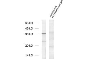 dilution: 1 : 1000, sample: cell lysate from Jurkat cells