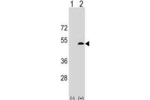 Western Blotting (WB) image for anti-Leupaxin (LPXN) antibody (ABIN2999719) (Leupaxin 抗体)