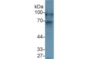 Western Blotting (WB) image for anti-Nexilin (NEXN) (AA 214-455) antibody (ABIN7439642)