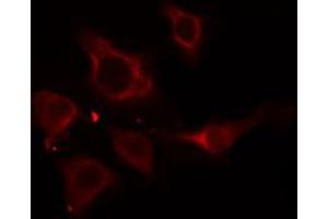 ABIN6274916 staining HepG2 cells by IF/ICC.