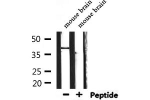 Western blot analysis of extracts from mouse brain, using TAS2R40 Antibody. (TAS2R40 抗体  (Internal Region))