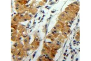 Used in DAB staining on fromalin fixed paraffin-embedded Stomach tissue (ANGPTL2 抗体  (AA 267-493))