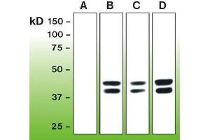 Western Blotting (WB) image for anti-Mitogen-Activated Protein Kinase 1/3 (MAPK1/3) (phosphospecific) antibody (ABIN870326) (ERK1/2 抗体  (phosphospecific))