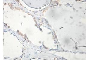 Immunohistochemical staining of formalin-fixed paraffin-embedded human thyroid showing membrane staining with FAM72A antibody at a dilution of 1/100. (FAM72A 抗体  (AA 2-148))