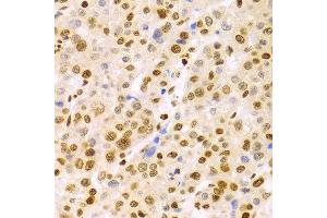 Immunohistochemistry (IHC) image for anti-Dyskeratosis Congenita 1, Dyskerin (DKC1) (AA 245-514) antibody (ABIN1512829)