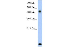 RSAD2 antibody used at 2. (RSAD2 抗体  (N-Term))