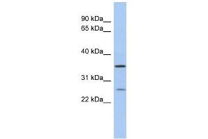 SDR-O antibody used at 1 ug/ml to detect target protein.