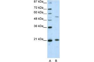 WB Suggested Anti-ZNF31 Antibody Titration:  2. (ZSCAN20 抗体  (N-Term))