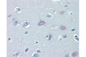 TRPM2 antibody was used for immunohistochemistry at a concentration of 4-8 ug/ml.