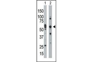 Western Blotting (WB) image for anti-Eukaryotic Translation Initiation Factor 2-alpha Kinase 2 (EIF2AK2) (AA 519-550), (C-Term) antibody (ABIN392779)
