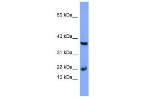 Myoglobin antibody used at 1 ug/ml to detect target protein. (Myoglobin 抗体  (N-Term))
