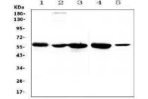 Western blot analysis of ETV6/Tel using anti-ETV6/Tel antibody (ABIN5693220). (ETV6 抗体  (AA 327-448))