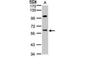 WB Image Sample(30 ug whole cell lysate) A:Hep G2 , 7. (PPP1R16A 抗体  (Center))