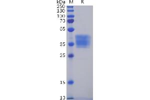 SDS-PAGE (SDS) image for Claudin 6 (CLDN6) (AA 1-4) protein (mFc Tag) (ABIN6961123)