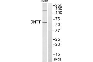 Western blot analysis of extracts from HepG2 cells, using DNTT antibody.