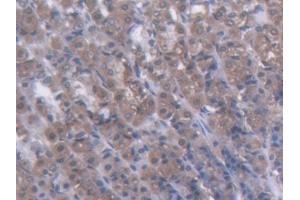 DAB staining on IHC-P; Samples: Rat Stomach Tissue (GCK 抗体  (AA 194-410))