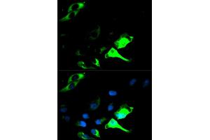 Immunofluorescence analysis of HeLa cell using KRT8 antibody. (KRT8 抗体  (AA 1-483))