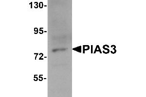Western Blotting (WB) image for anti-Protein Inhibitor of Activated STAT, 3 (PIAS3) (C-Term) antibody (ABIN1030584)