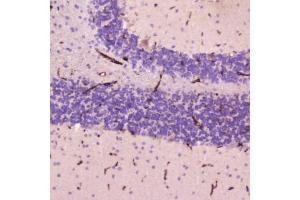 IHC testing of FFPE human cerebellum tissue with C-Reactive Protein antibody at 2ug/ml. (CRP 抗体  (AA 20-230))