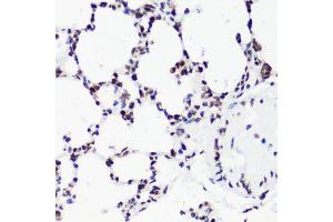 Immunohistochemistry (Paraffin-embedded Sections) (IHC (p)) image for anti-Histone 3 (H3) (H3K36me2) antibody (ABIN3016036)