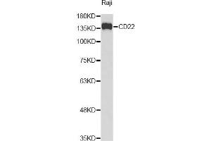 Western blot analysis of extracts of Raji cells, using CD22 Antibody. (CD22 抗体)