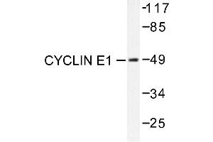 Image no. 1 for anti-Cyclin E1 (CCNE1) antibody (ABIN265380) (Cyclin E1 抗体)