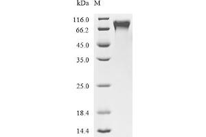 (Tris-Glycine gel) Discontinuous SDS-PAGE (reduced) with 5 % enrichment gel and 15 % separation gel.