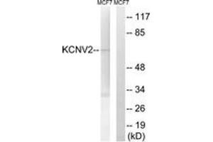 Western blot analysis of extracts from MCF-7 cells, using KCNV2 Antibody. (KCNV2 抗体  (AA 187-236))
