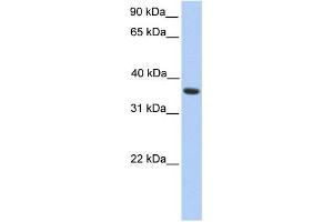 WB Suggested Anti-MAGEA4 Antibody Titration: 0. (MAGEA4 抗体  (C-Term))