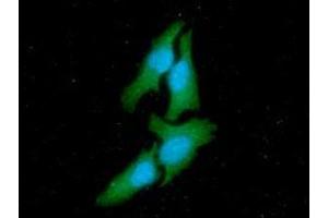 ICC/IF analysis of CSK in HeLa cells line, stained with DAPI (Blue) for nucleus staining and monoclonal anti-human CSK antibody (1:100) with goat anti-mouse IgG-Alexa fluor 488 conjugate (Green) (CSK 抗体  (AA 1-450))