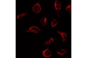 Immunofluorescence (fixed cells) (IF/ICC) image for anti-Estrogen Receptor 1 (ESR1) (pTyr537) antibody (ABIN6255950)