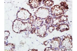 Paraformaldehyde-fixed, paraffin embedded rat mammary gland), Antigen retrieval by boiling in sodium citrate buffer (pH6) for 15min, Block endogenous peroxidase by 3% hydrogen peroxide for 30 minutes, Blocking buffer (normal goat serum) at 37°C for 20min, Antibody incubation with 	PRKCDBP Polyclonal Antibody, Unconjugated ( 	 ) at 1:500 overnight at 4°C, followed by a conjugated secondary and DAB staining. (PRKCDBP 抗体  (AA 151-250))