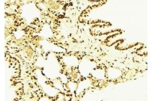 ABIN6277732 at 1/100 staining Mouse lung tissue by IHC-P. (NRF2 抗体  (pSer40))