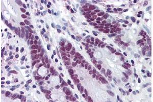 Human Small Intestine: Formalin-Fixed, Paraffin-Embedded (FFPE) (HDAC1 抗体  (AA 1-483))