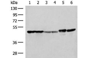 Western blot analysis of Hela A375 Human fetal liver tissue Human fetal brain tissue HepG2 cell and Mouse brain tissue lysates using FLOT2 Polyclonal Antibody at dilution of 1:350 (Flotillin 2 抗体)