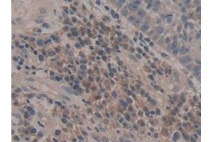 Immunohistochemistry (IHC) image for anti-Caspase 5, Apoptosis-Related Cysteine Peptidase (CASP5) (AA 145-327) antibody (ABIN7432568)