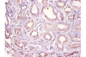 Immunohistochemistry of paraffin-embedded human kidney using DHRS9 antibody at dilution of 1:100. (DHRS9 抗体  (HRP))