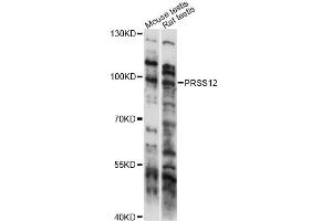 Western blot analysis of extracts of various cell lines, using PRSS12 antibody (ABIN6292705) at 1:1000 dilution. (Neurotrypsin 抗体)