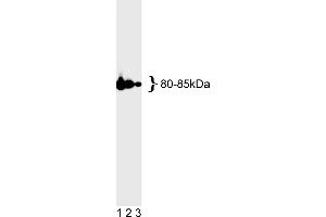 Western Blotting (WB) image for anti-MutL Homolog 1 (MLH1) antibody (ABIN967315) (MLH1 抗体)